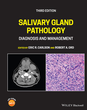 Carlson / Ord |  Salivary Gland Pathology | Buch |  Sack Fachmedien