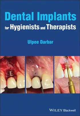 Darbar |  Dental Implants for Hygienists and Therapists | Buch |  Sack Fachmedien