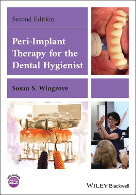 Wingrove |  Peri-Implant Therapy for the Dental Hygienist | Buch |  Sack Fachmedien