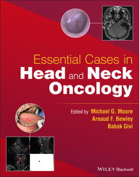 Moore / Givi / Bewley |  Essential Cases in Head and Neck Oncology | Buch |  Sack Fachmedien