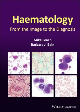 Bain / Leach |  Haematology | Buch |  Sack Fachmedien