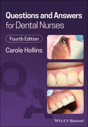 Hollins |  Questions and Answers for Dental Nurses | Buch |  Sack Fachmedien