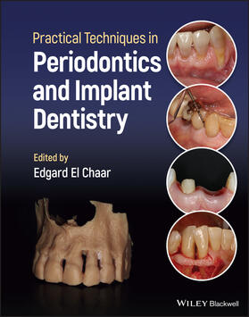 El Chaar |  Practical Techniques in Periodontics and Implant Dentistry | Buch |  Sack Fachmedien