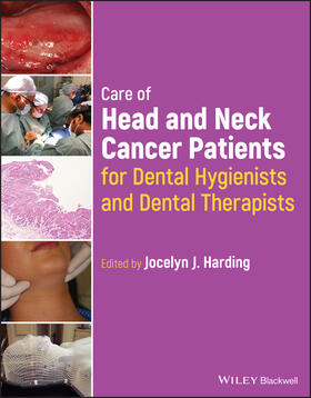 Harding |  Care of Head and Neck Cancer Patients for Dental Hygienists and Dental Therapists | Buch |  Sack Fachmedien