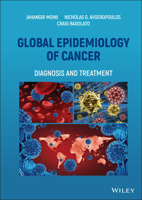 Moini / Avgeropoulos / Badolato |  Global Epidemiology of Cancer | Buch |  Sack Fachmedien