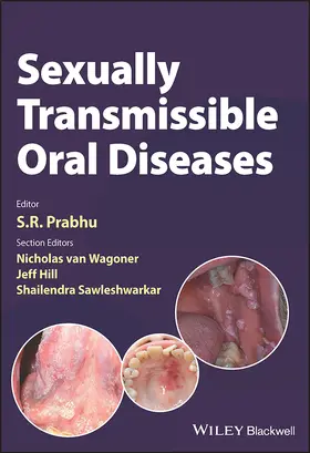 Prabhu / Van Wagoner / Hill |  Sexually Transmissible Oral Diseases | Buch |  Sack Fachmedien