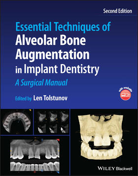 Tolstunov |  Essential Techniques of Alveolar Bone Augmentation in Implant Dentistry | Buch |  Sack Fachmedien