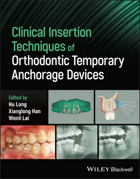 Long / Han / Lai |  Clinical Insertion Techniques of Orthodontic Temporary Anchorage Devices | Buch |  Sack Fachmedien