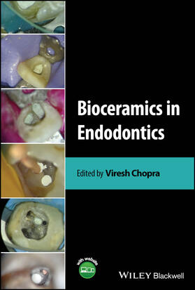 Chopra |  Bioceramics in Endodontics | Buch |  Sack Fachmedien