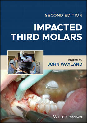 Wayland |  Impacted Third Molars | Buch |  Sack Fachmedien