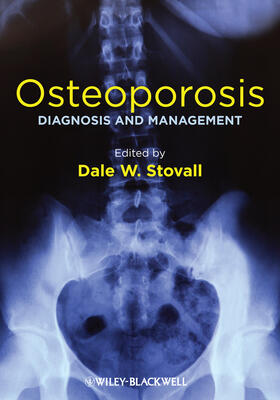 Stovall |  Osteoporosis | Buch |  Sack Fachmedien
