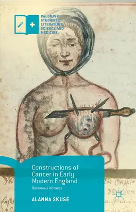 Skuse |  Constructions of Cancer in Early Modern England | Buch |  Sack Fachmedien