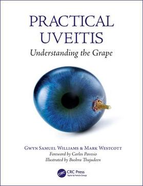 Williams / Westcott |  Practical Uveitis | Buch |  Sack Fachmedien