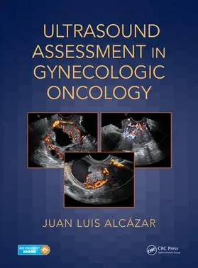 Alcazar / Alcázar |  Ultrasound Assessment in Gynecologic Oncology | Buch |  Sack Fachmedien