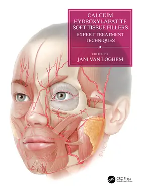 Van Loghem |  Calcium Hydroxylapatite Soft Tissue Fillers | Buch |  Sack Fachmedien