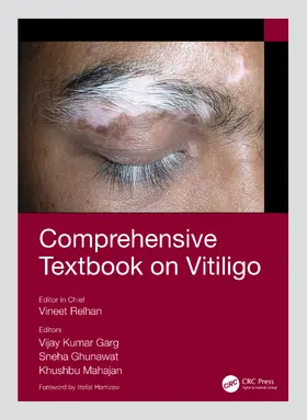 Relhan / Garg / Ghunawat |  Comprehensive Textbook on Vitiligo | Buch |  Sack Fachmedien