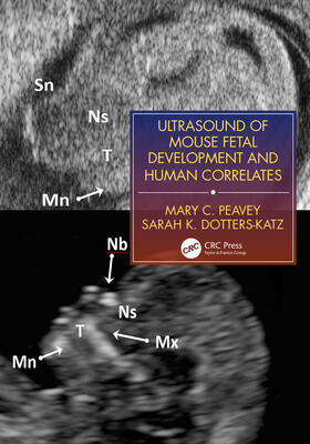 Peavey / Dotters-Katz |  Ultrasound of Mouse Fetal Development and Human Correlates | Buch |  Sack Fachmedien