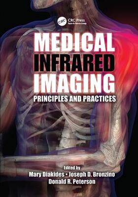 Diakides / Bronzino / Peterson |  Medical Infrared Imaging | Buch |  Sack Fachmedien