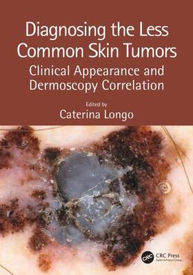 Longo |  Diagnosing the Less Common Skin Tumors | Buch |  Sack Fachmedien