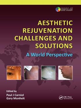 Carniol / Monheit |  Aesthetic Rejuvenation Challenges and Solutions | Buch |  Sack Fachmedien