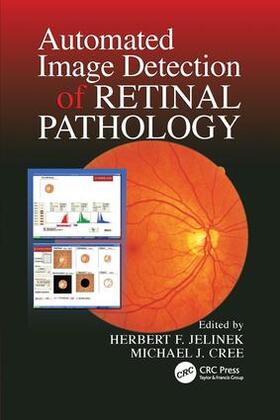 Jelinek / Cree |  Automated Image Detection of Retinal Pathology | Buch |  Sack Fachmedien