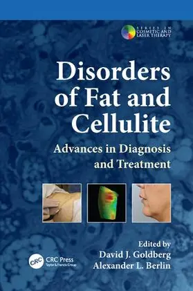 Goldberg / Berlin |  Disorders of Fat and Cellulite | Buch |  Sack Fachmedien