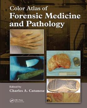 Catanese / Heaton |  Color Atlas of Forensic Medicine and Pathology | Buch |  Sack Fachmedien