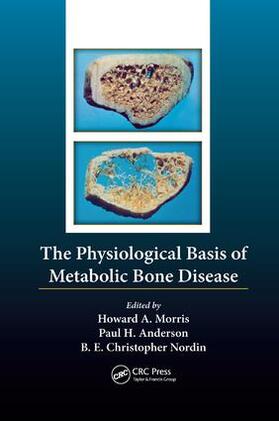 Nordin / Morris / Anderson |  The Physiological Basis of Metabolic Bone Disease | Buch |  Sack Fachmedien