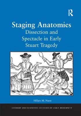 Nunn |  Staging Anatomies | Buch |  Sack Fachmedien