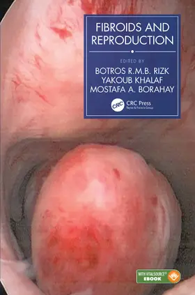 Rizk / Khalaf / Borahay |  Fibroids and Reproduction | Buch |  Sack Fachmedien