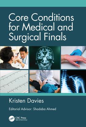 Davies |  Core Conditions for Medical and Surgical Finals | Buch |  Sack Fachmedien