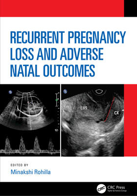 Rohilla |  Recurrent Pregnancy Loss and Adverse Natal Outcomes | Buch |  Sack Fachmedien