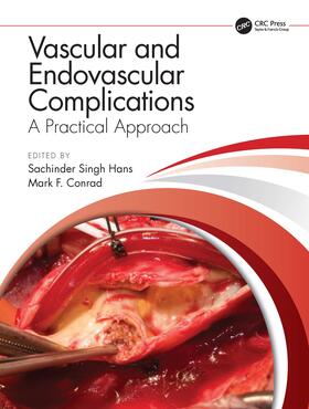 Hans / Conrad |  Vascular and Endovascular Complications: A Practical Approach | Buch |  Sack Fachmedien