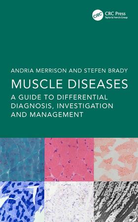 Merrison / Brady |  Muscle Diseases | Buch |  Sack Fachmedien