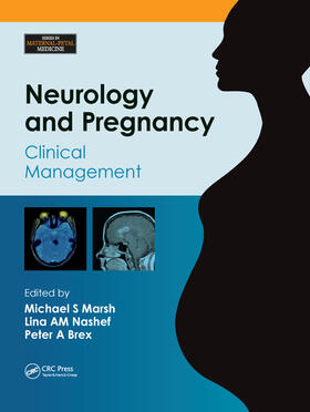 Marsh / Nashef / Brex |  Neurology and Pregnancy | Buch |  Sack Fachmedien