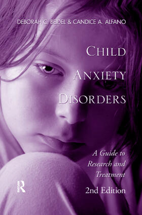 Beidel / Alfano |  Child Anxiety Disorders | Buch |  Sack Fachmedien