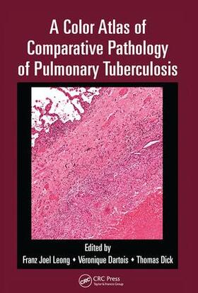 Leong / Dartois / Dick |  A Color Atlas of Comparative Pathology of Pulmonary Tuberculosis | Buch |  Sack Fachmedien