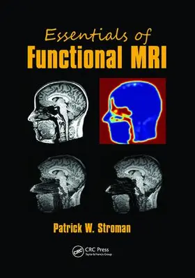 Stroman |  Essentials of Functional MRI | Buch |  Sack Fachmedien