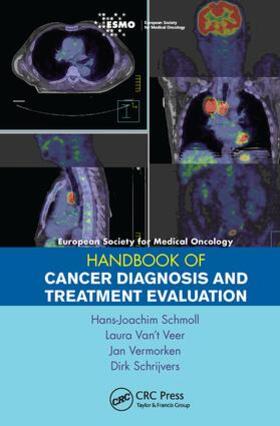 Schmoll |  ESMO Handbook of Cancer Diagnosis and Treatment Evaluation | Buch |  Sack Fachmedien