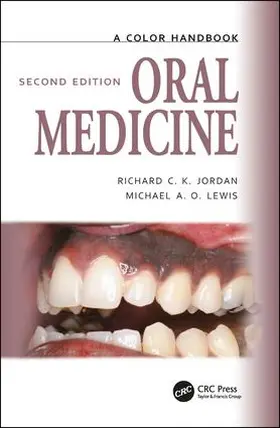 Lewis / Jordan |  Oral Medicine | Buch |  Sack Fachmedien