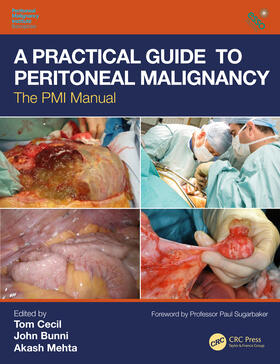 Cecil / Bunni / Mehta |  A Practical Guide to Peritoneal Malignancy: The PMI Manual | Buch |  Sack Fachmedien