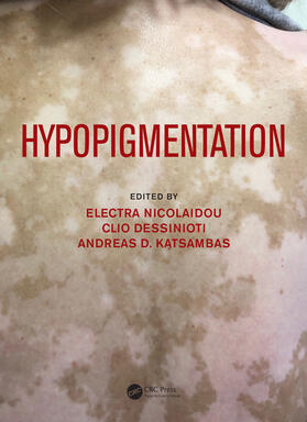 Nicolaidou / Dessinioti / Katsambas |  Hypopigmentation | Buch |  Sack Fachmedien