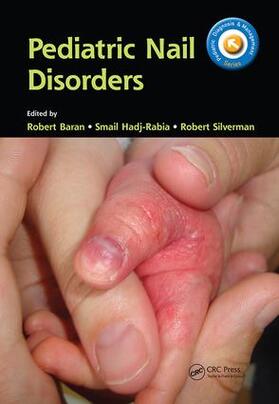 Baran / Hadj-Rabia / Silverman |  Pediatric Nail Disorders | Buch |  Sack Fachmedien