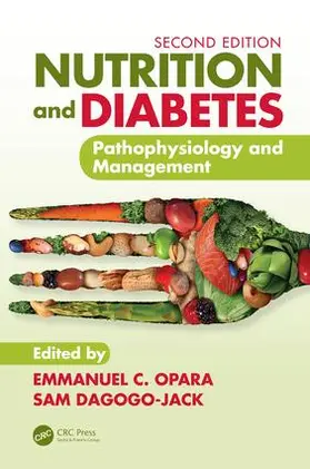 Dagogo-Jack / Opara |  Nutrition and Diabetes | Buch |  Sack Fachmedien