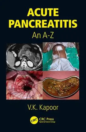 Kapoor / Beger |  Acute Pancreatitis | Buch |  Sack Fachmedien