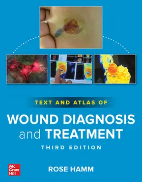 Hamm |  Text and Atlas of Wound Diagnosis and Treatment, Third Edition | Buch |  Sack Fachmedien