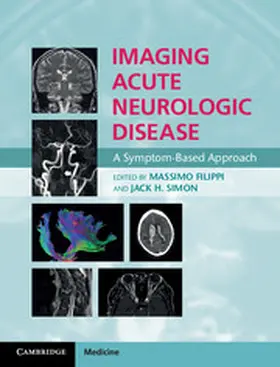 Filippi / Simon |  Imaging Acute Neurologic Disease | eBook | Sack Fachmedien