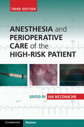 McConachie |  Anesthesia and Perioperative Care of the High-Risk Patient | eBook | Sack Fachmedien