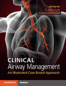 Doyle / Abdelmalak |  Clinical Airway Management | Buch |  Sack Fachmedien