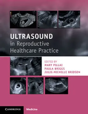 Pillai / Briggs / Bridson |  Ultrasound in Reproductive Healthcare Practice | Buch |  Sack Fachmedien